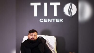 صورة توضيحية - مركز Tito يحقق النجاح على مستوى زراعة الشعر