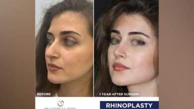 جورج زيادة في حديث حول عمليات تجميل الأنف/Rhinoplasty